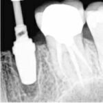 31945981_1819491415018943_5667597702309871616_n