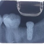 41863899_1911023539199063_2602742574988918784_n