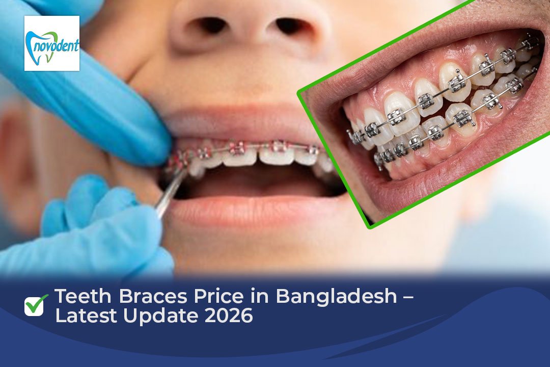 Teeth Braces Price in Bangladesh – Latest Update 2026