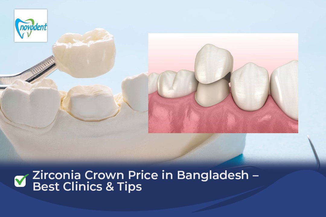 Zirconia Crown Price in Bangladesh – Full