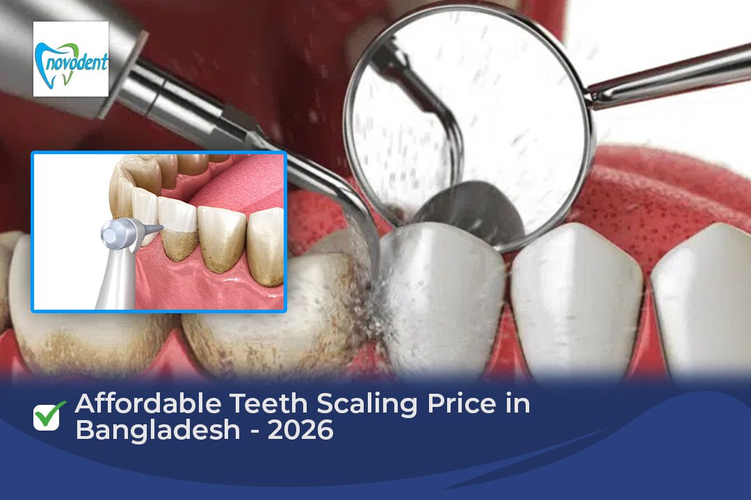 Affordable Teeth Scaling Price in Bangladesh - 2026