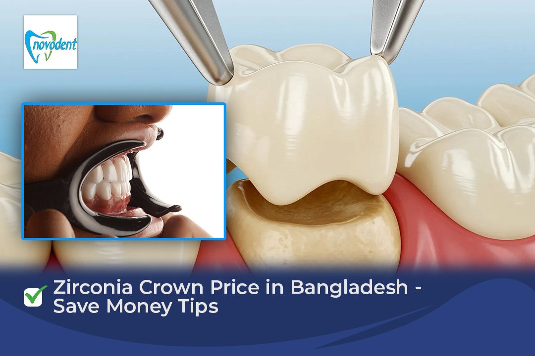 Zirconia Crown Price in Bangladesh - Save Money Tips