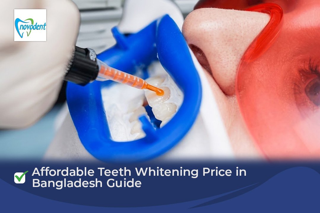 Affordable Teeth Whitening Price in Bangladesh Guide
