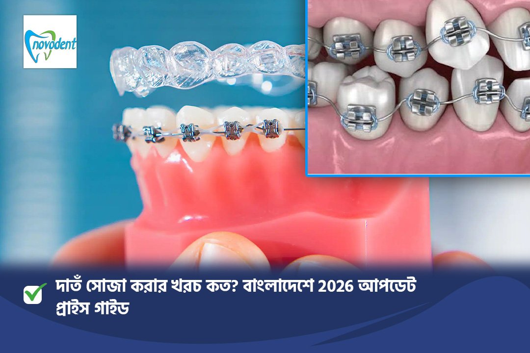 দাঁত সোজা করার খরচ কত? বাংলাদেশে 2026 আপডেট প্রাইস গাইড