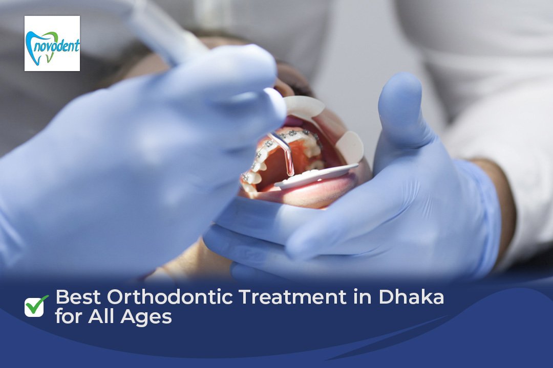 Best Orthodontic Treatment in Dhaka for All Ages