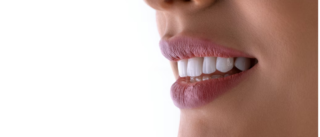 Affordable Teeth Whitening Price in Bangladesh Guide