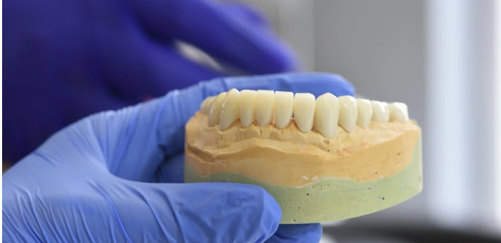 Zirconia Crown Price in Bangladesh - Save Money Tips