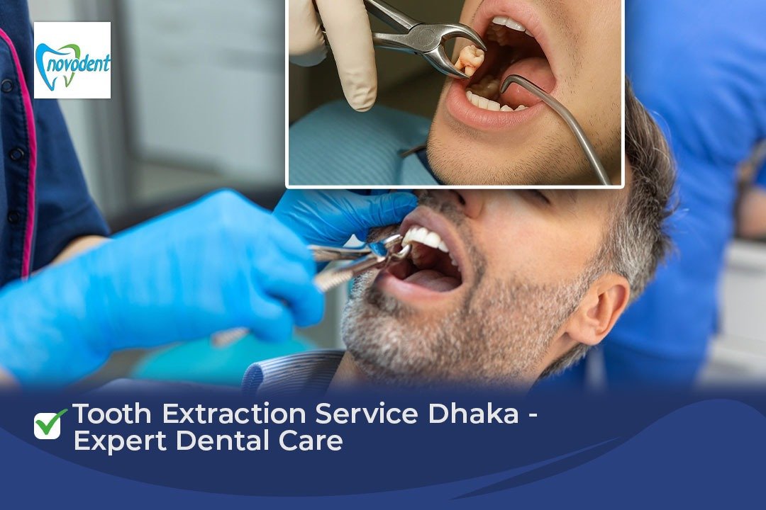 Tooth Extraction Service Dhaka – Expert Dental Care Tooth Extraction Service Dhaka - Expert Dental Care