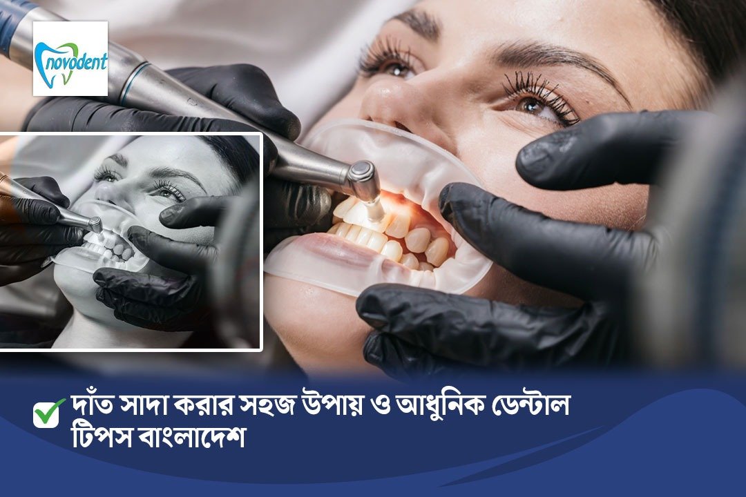 দাঁত সাদা করার সহজ উপায় ও আধুনিক ডেন্টাল টিপস বাংলাদেশ