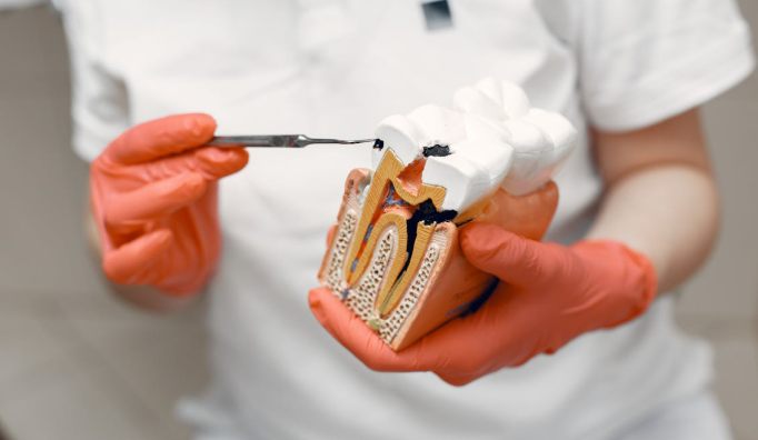 Root Canal Treatment Bangladesh 