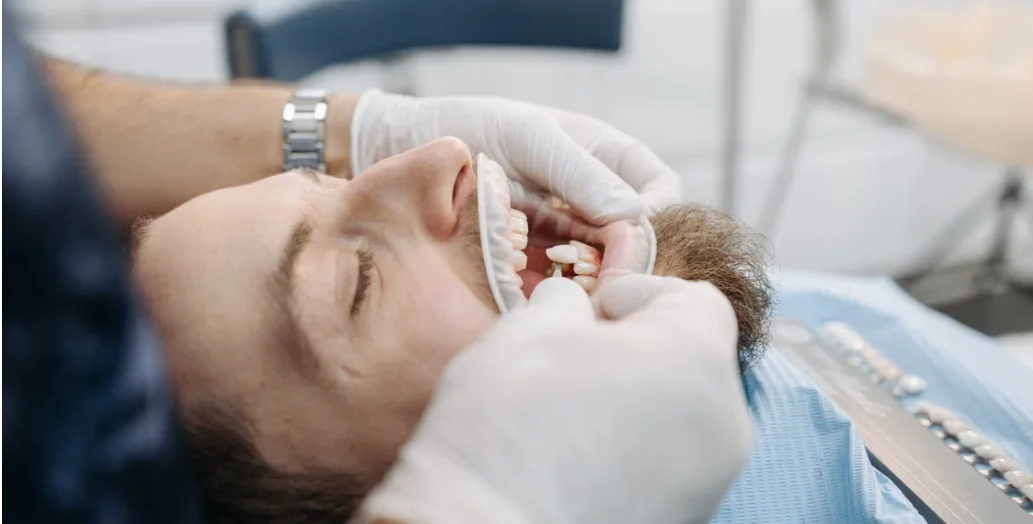 Dental Crowns in Bangladesh